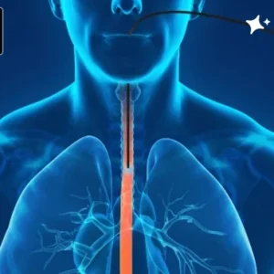 Manometría de Alta Resolución